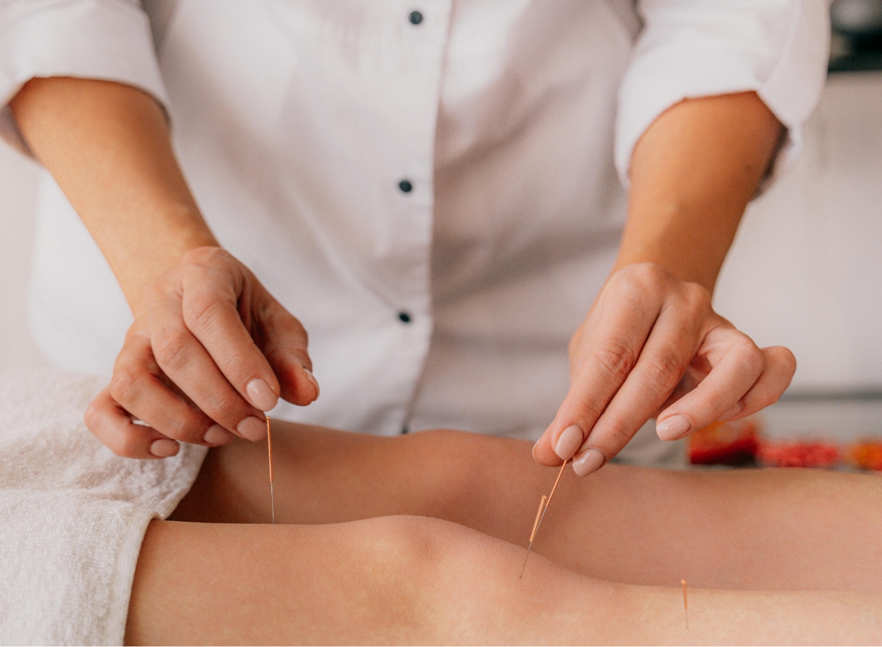 Acupuncture in St. Albert for blood flow regulation