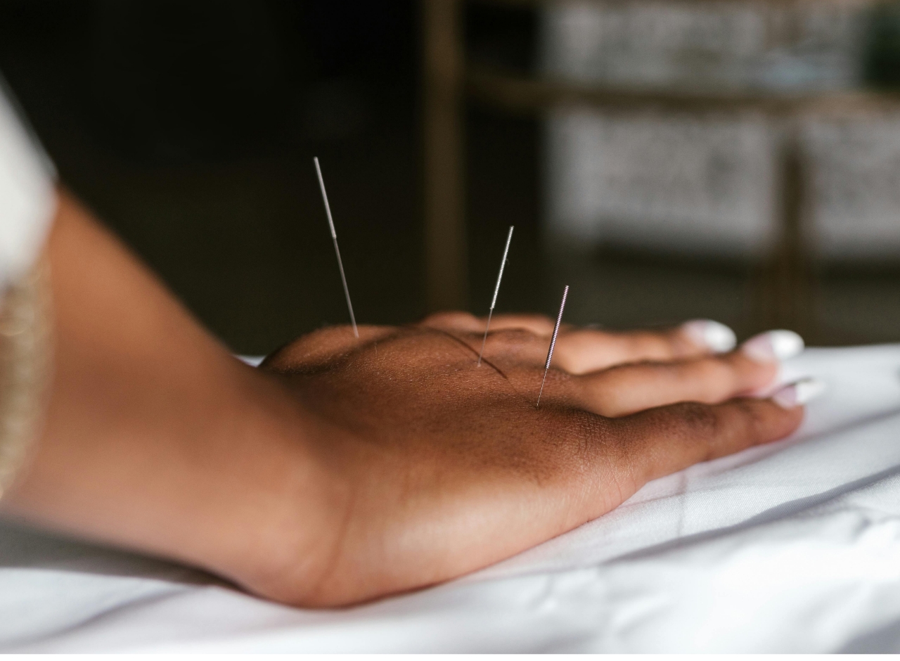 Health by Hamdon provides acupuncture treatments to aid healing